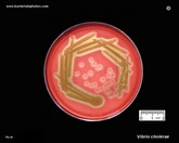 vibrio cholerae appearance on blood agar plate